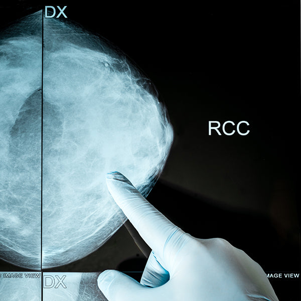 Profiles CDx - Cancer Confirmation Diagnosis